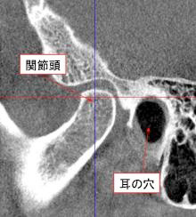 頭痛、顔面痛について9