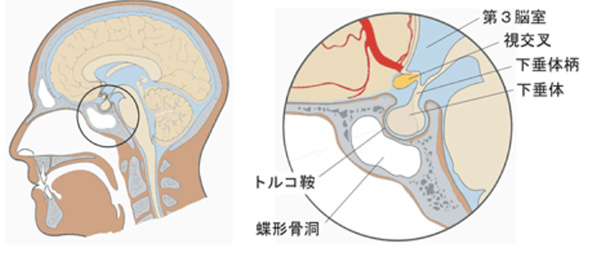 頭痛と噛み合わせの関係