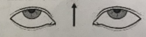 噛み合わせ