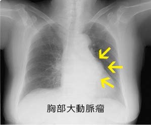 アスリートの噛み合わせと今後-その3_2