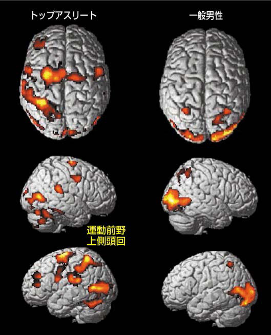 アスリートに見る顔の歪みと首の回旋可動域-噛み合わせの調整の有効性-32