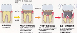 患わないことがいかに大切かについて-その2-2